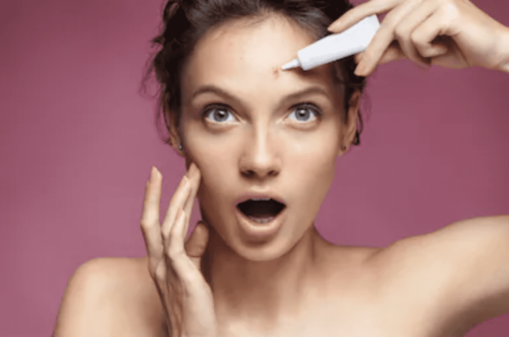 Are You Having Trouble Controlling Your Acne? | The Spa MD In Rochester Hills, MI