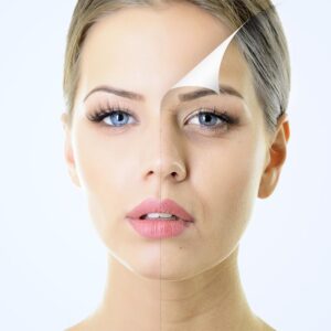 Peeling Makeup Problem Top 5 Skin Problems Fixed With A Chemical Peel Treatment
