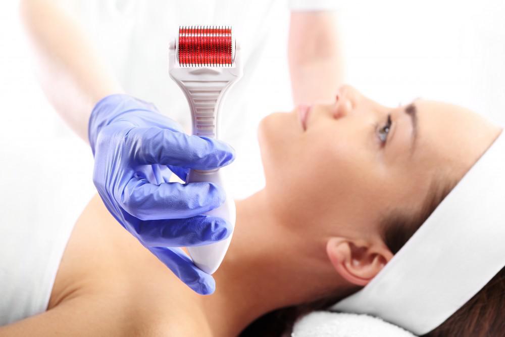 Microneedling for Sun-Damaged Skin What to Expect | The Spa MD In Rochester Hills, MI