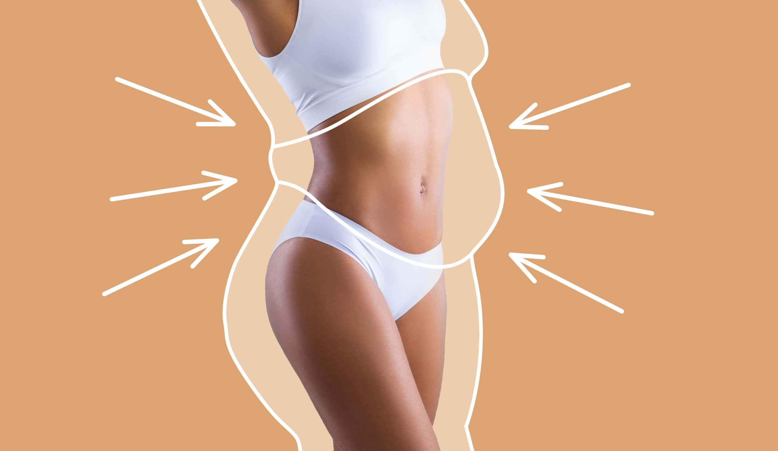 CoolSculpting