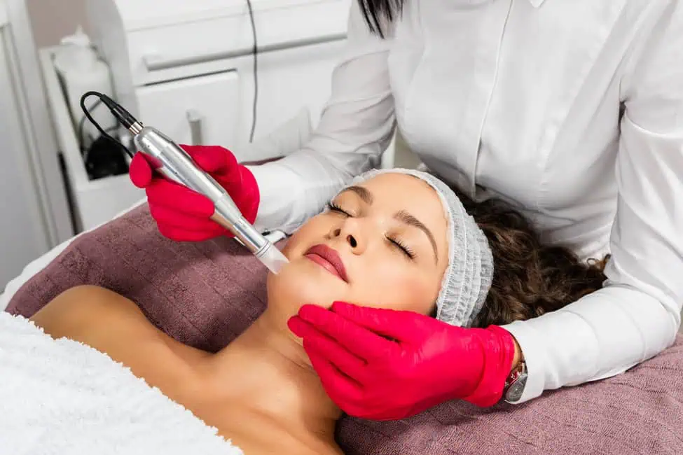 Microneedling by Plastic Surgery Arts in Rochester Hills, MI