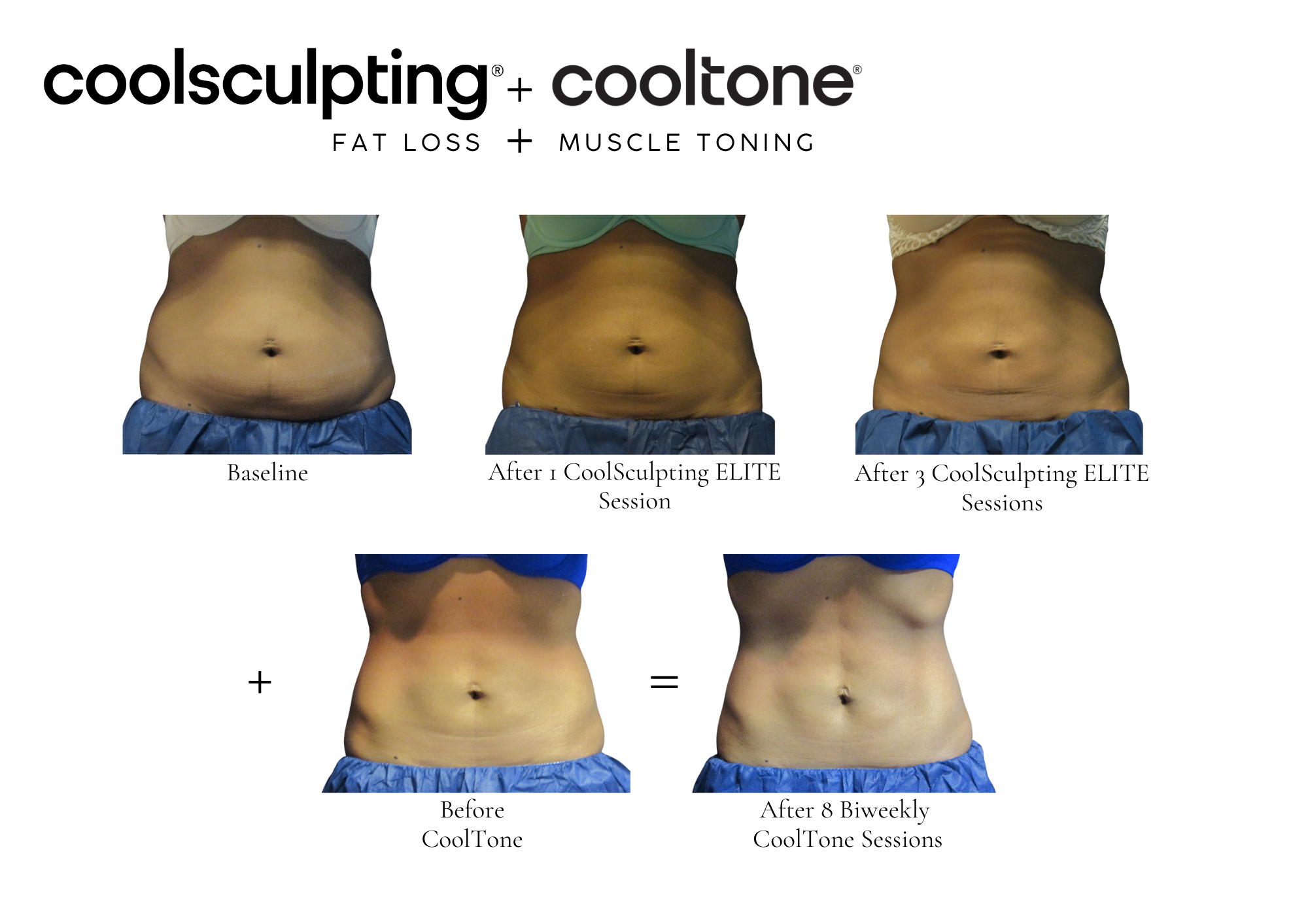 b12 injections rochester hills mi Body Contouring to Sculpt Your Shape Vitamin B12 Booster Shot 29G Insulin Syringe with Needle Size:5ml Dropper Bottle