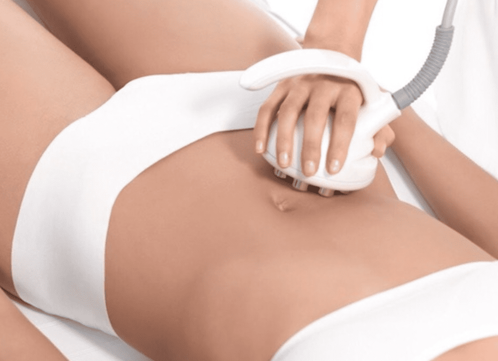 How Traditional Liposuction is Performed | The Spa MD In Rochester Hills, MI