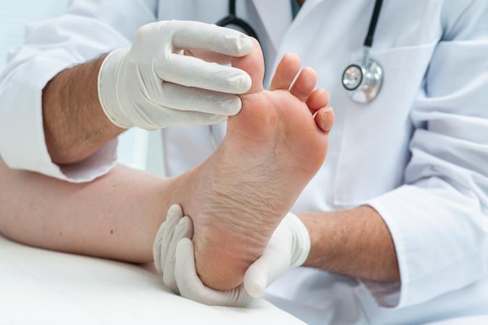 Our Tips for Avoiding Toenail Fungus | The Spa MD In Rochester Hills, MI